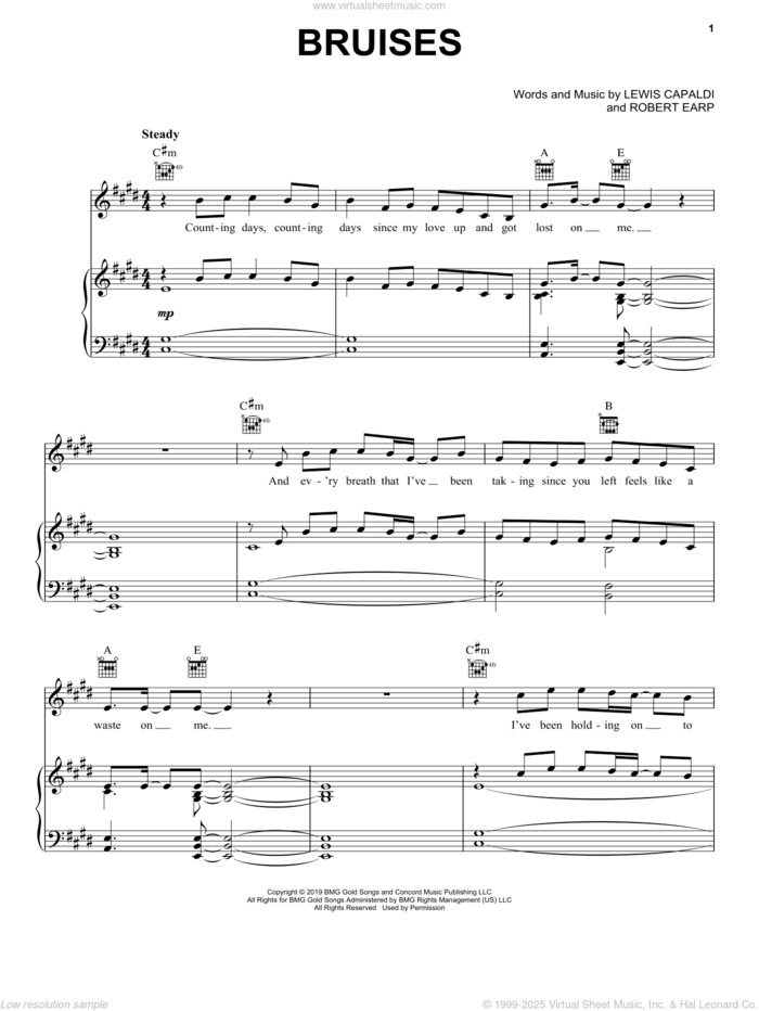 Bruises sheet music for voice, piano or guitar by Lewis Capaldi and Robert Earp, intermediate skill level