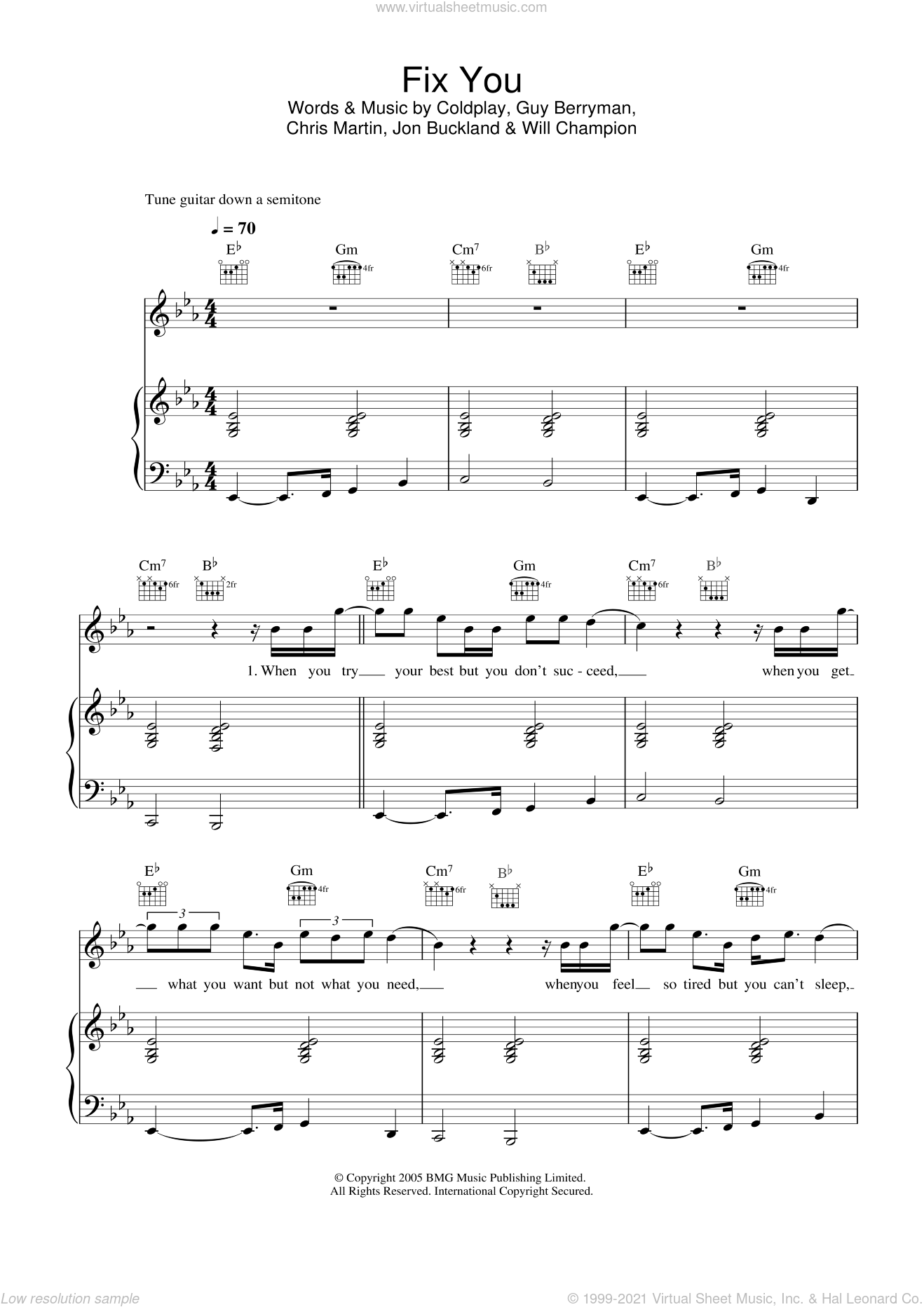 Fix You Sheet Music For Voice, Piano Or Guitar (PDF-interactive)