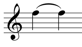 Is this a slur or a tie?